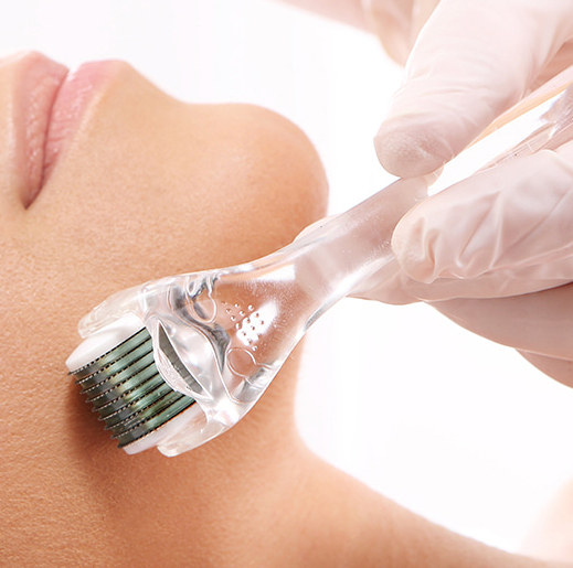 차침 (microneedling, MTS) 사진