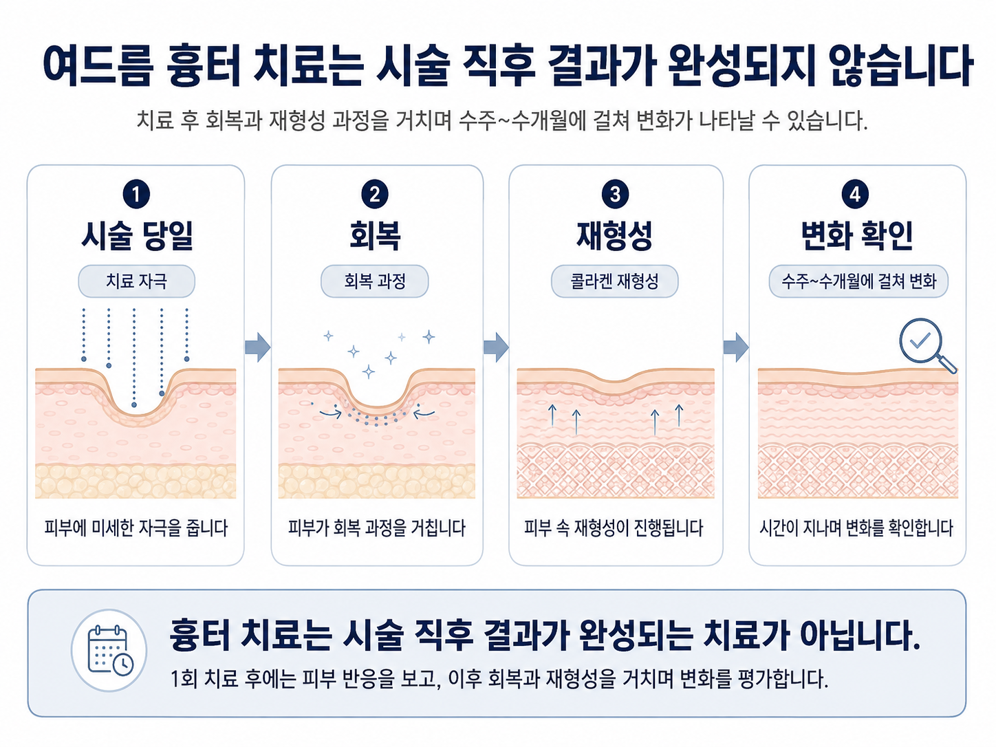 여드름 흉터는 치료 후 회복과 재형성 과정을 거치며 수주~수개월에 걸쳐 변화가 나타남을 보여주는 그림
